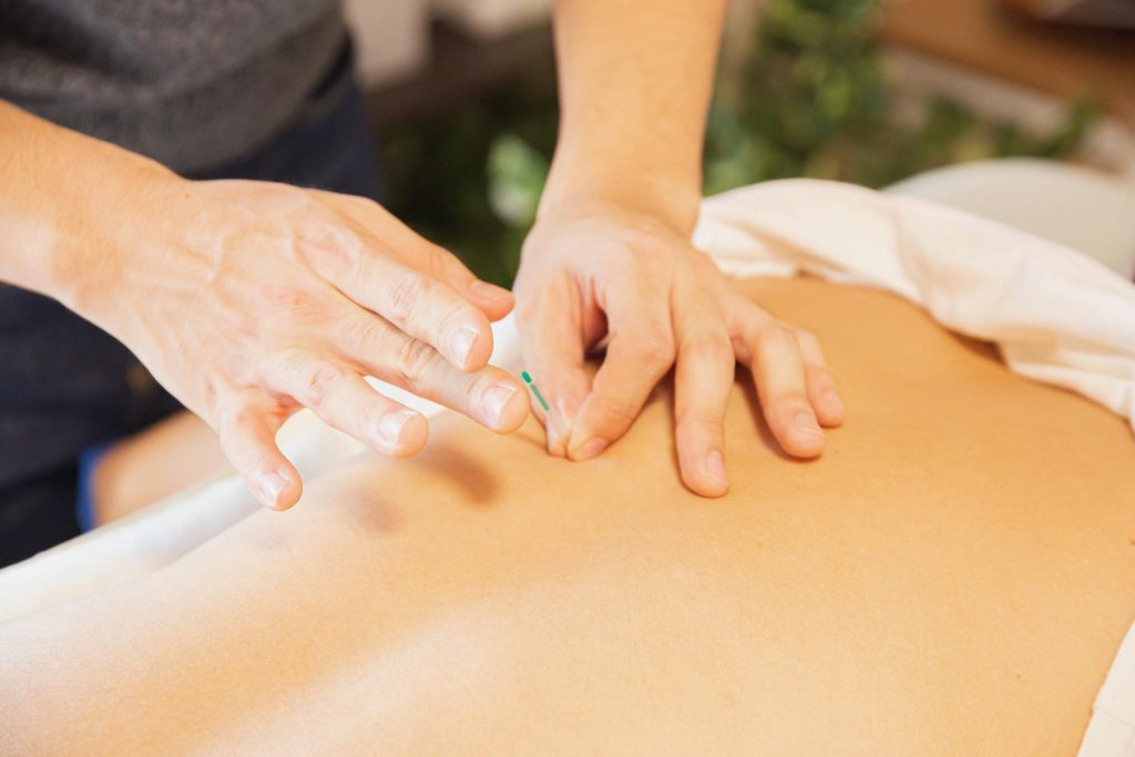 About 1 From above of crop anonymous man applying needles on back of client during acupuncture procedure
